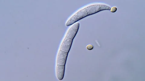 Fusarium Conidia Observed with Microscopic Detail, 1000x 動画素材 317812358