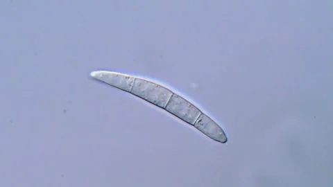 Fusarium Conidial Structures in Microscopic Detail Stock-Footage 317810084