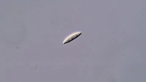 Fusarium Fungus Spore, microscope view 400x magnification Stock-Footage 317810402