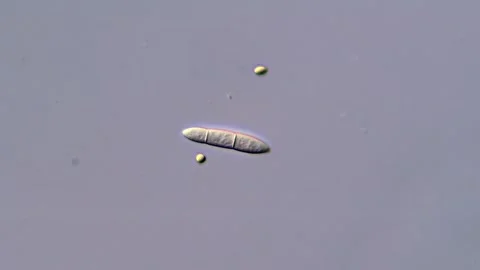 Fusarium Fungus Spore, microscope view 400x 動画素材 317811747