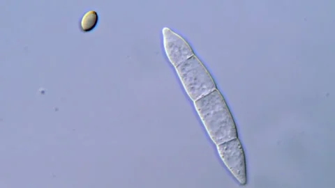 Fusarium Macroconidia in Close Up Microscopic View 動画素材 317810081