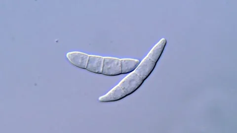 Fusarium Macroconidia Observed Under Microscope, 1000x 動画素材 317811754