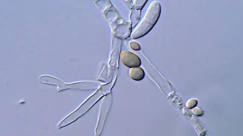 Fusarium Mycelial Network and Spore Visualization, 1000x 库存影片 317812181