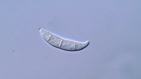 Fusarium Spore Microscopy with Close Up Focus, 1000x 動画素材 317810187