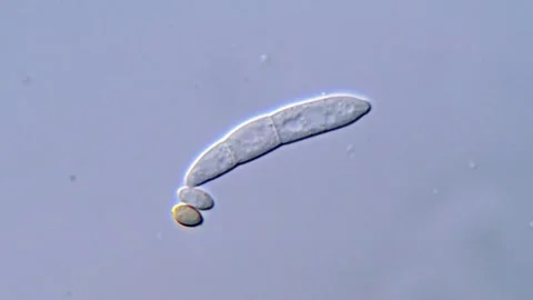 Fusarium Spore Microscopy for Scientific Observation Stock-Footage 317810388