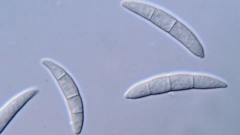Fusarium Spore Microscopy for Scientific Observation, 1000x 動画素材 317812757
