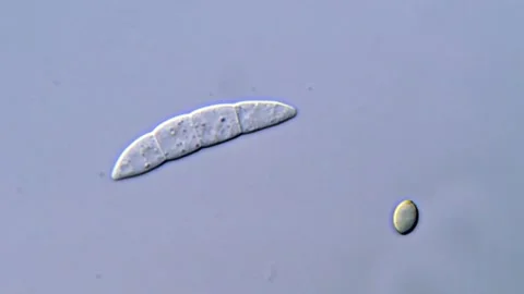 Fusarium Spore Morphology Under High Resolution, 1000x Vídeos de archivo 317810323
