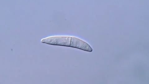 Fusarium Spore Morphology Under High Resolution Microscopy, 1000x 動画素材 317811831