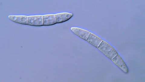 Fusarium Spore Observation with Compound Microscope, 1000x 動画素材 317812455