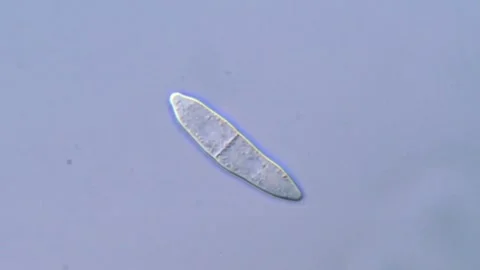 Fusarium Spores Under Compound Microscope, 1000x magnification 動画素材 317812144