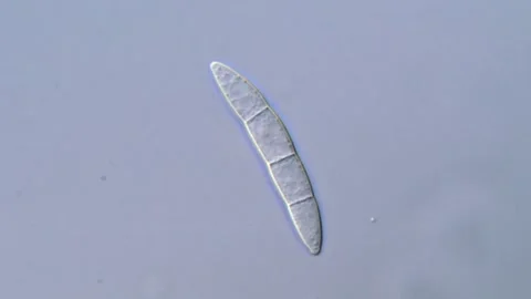 Fusarium Spores Under Compound Microscope, 1000x 動画素材 317812448