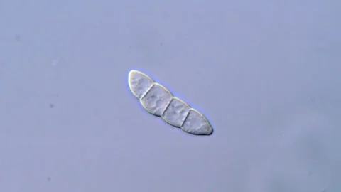 Fusarium Spores Under DIC Microscope, 1000x magnification 動画素材 317812264