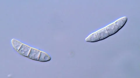 Fusarium Spores Under DIC Microscope, 1000x magnification 動画素材 317812670