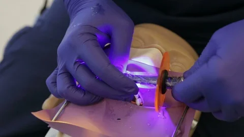 Future Dentist Light Curing a Front Tooth Filling Stock Footage 106324263