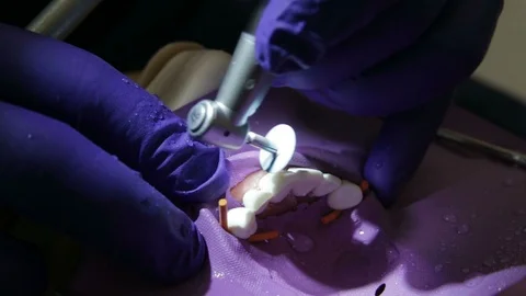 Future Dentist Refining a Front Tooth Filling With a Drill Stock Footage 106324330
