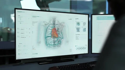 Futuristic analysis software finds dangerous blood clots in the patients heart Stock Footage 253192357
