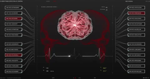 Futuristic brain interface with HUD and infographic elements Stock Footage 194255614