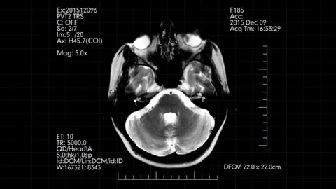 Futuristic display animation of MRI brai... | Stock Video | Pond5