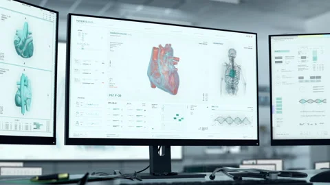 Futuristic Healthcare software examination identifies Cardiac Ischemia disease Stock Footage 245235682