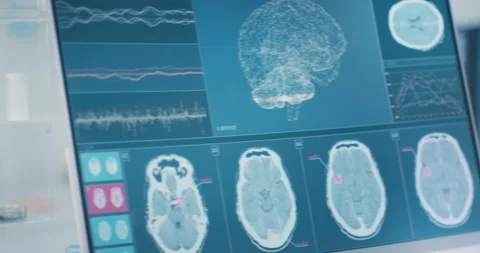Futuristic laboratory. Brainwave scanning models and DNA sequences Video stock 146105609
