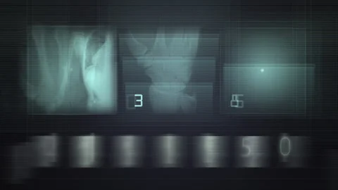 Futuristic Medical Imaging Interface Showing Digital Diagnostic Analysis Stock-Footage 305062170