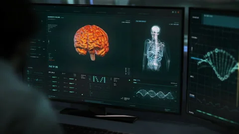 Futuristic Medical MRT Software For Diagnostic Of The Tumors Of A Patient Stock Footage 166566117