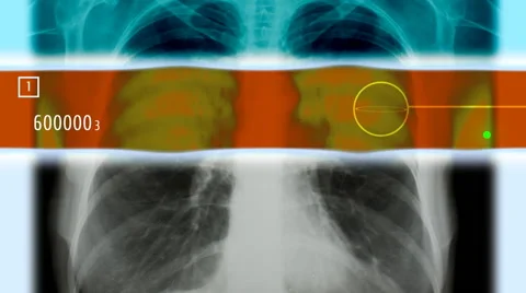 A Futuristic scan of a Human Chest (Loop) Stock Footage 41436394