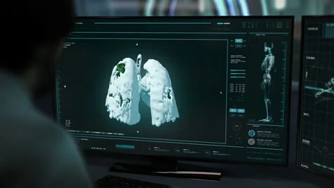 Futuristic system inspecting the Covid-19 virus pneumonia for patient therapy Stock Footage 168768503