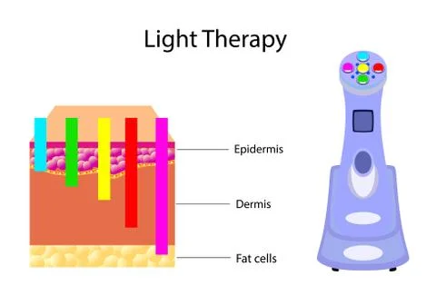 Gadget for Light Therapy and chart, vector illustration Stock Illustration