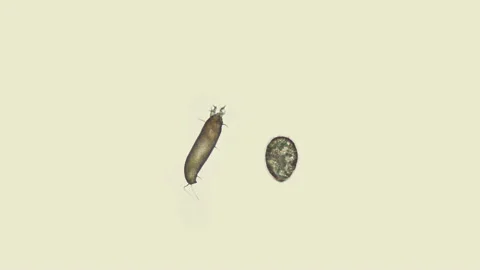 Gall mite (acari) Eriophyoidea under the microscope, order Trombidiformes Stock Footage 133521613