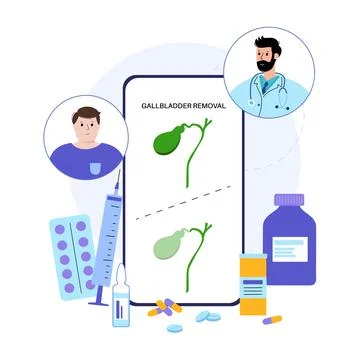 Gallbladder removal surgery Stock Illustration
