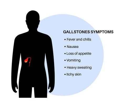 Gallbladder stones symptoms Illustrazione stock