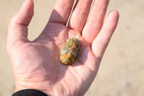 Gallstone in hand, Gall bladder stone. result of gallstones. Calculus of hete Foto stock