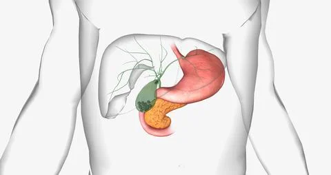 Gallstones are pieces of solid material that form in the gallbladder, a sma.. Stock Illustration