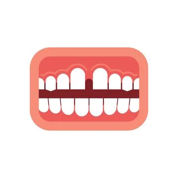Gap mouth. Large space between teeth. Stock Illustration