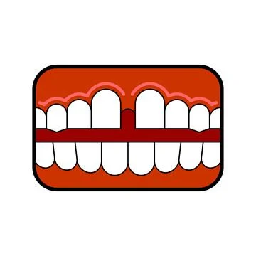 Gap mouth. Large space between teeth. Stock Illustration