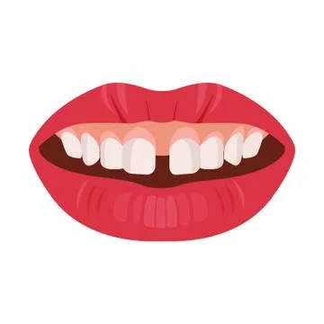 Gap teeth concept. Dental tooth problem and treatment. Dentistry care. Vector Stock Illustration