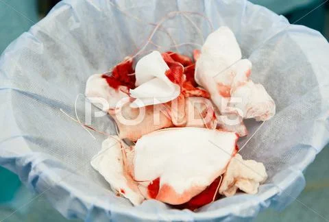 Garbage with blood on surgery Stock Photos
