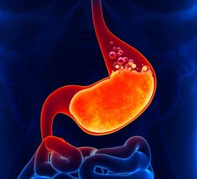 Gastric Acid 스톡 일러스트