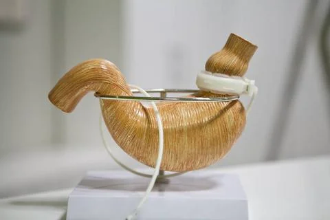 Gastric Band Gastric band to decrease the capacity of the stomach to contr... Stock Photos