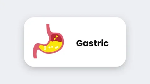 Gastric Stock Footage 334462032