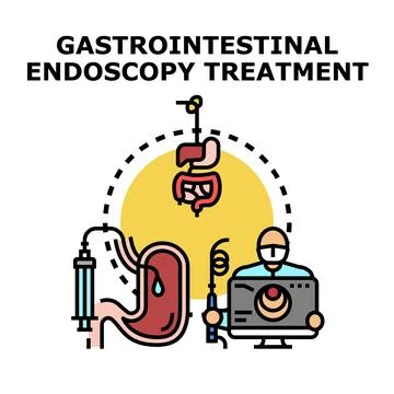 Gastrointestinal endoscopy procedure diagnosing digestive system issues Stock Illustration