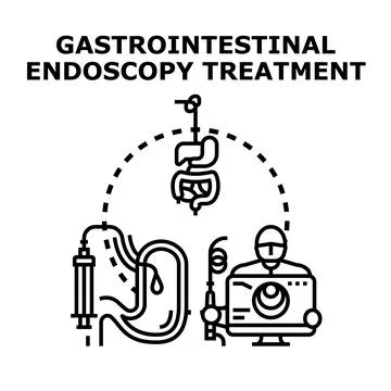 Gastrointestinal endoscopy procedure diagnosing digestive system issues Stock Illustration