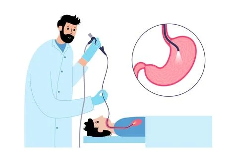 Gastroscopy endoscopy procedure Stock Illustration