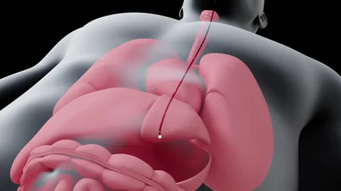 Gastroscopy 스톡 동영상 196286099