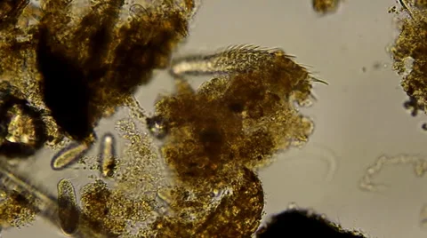 Gastrotrich 2b 1920 Video stock 35476299