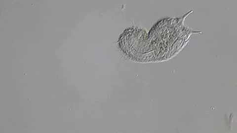 Gastrotrich under microscope, pond water sample Vidéo 306585982