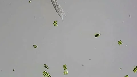 Gastrotrich under microscope view 400x 库存影片 306585925