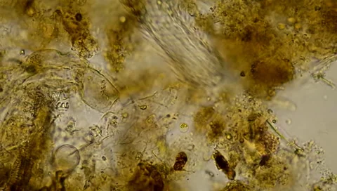 Gastrotrich4 p1 Video stock 35476241