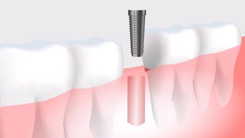 Gear animation Stock Footage 241199270
